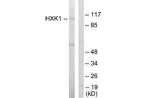 Western blot analysis of extracts from HeLa cells, using HXK1 Antibody. (Hexokinase 1 anticorps  (AA 31-80))