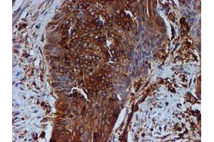 Image no. 1 for anti-Tubulin beta 4a (TUBB4A) antibody (ABIN1501579)