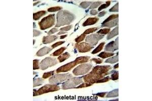 Immunohistochemistry (IHC) image for anti-Elastin Microfibril Interfacer 1 (EMILIN1) antibody (ABIN3002724) (Emilin1 anticorps)