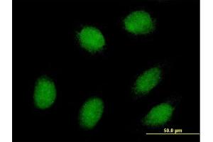 Immunofluorescence of purified MaxPab antibody to EXOSC1 on HeLa cell. (EXOSC1 anticorps  (AA 1-195))