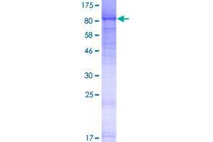 Image no. 1 for Leucine Rich Repeat Containing 4C (LRRC4C) (AA 1-640) protein (GST tag) (ABIN1309781)