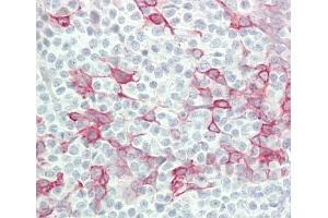 anti-Interferon, alpha 4 (IFNa4) (AA 162-189), (C-Term) antibody