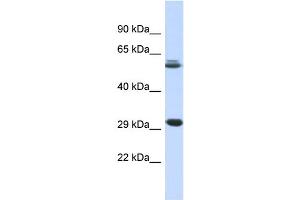 Host:  Rabbit  Target Name:  PCGF3  Sample Type:  Fetal Muscle lysates  Antibody Dilution:  1. (PCGF3 anticorps  (Middle Region))