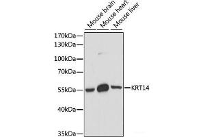 Western blot analysis of extracts of various cell lines using KRT14 Polyclonal Antibody at dilution of 1:1000. (KRT14 anticorps)