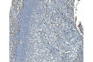 IHC analysis of SND1 using anti-SND1 antibody (ABIN7600526). (SND1 anticorps  (AA 20-204))