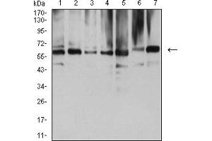 Western blot analysis using NAA10 mouse mAb against COS7 (1), HEK293 (2), HL-60 (3), MCF-7 (4), Hela (5), NIH/3T3 (6), and C2C12 (7) cell lysate.