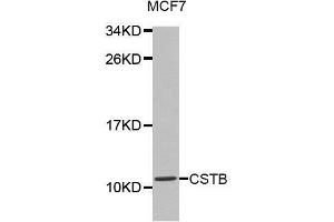 Western blot analysis of extracts of MCF7 cell lines, using CSTB antibody.