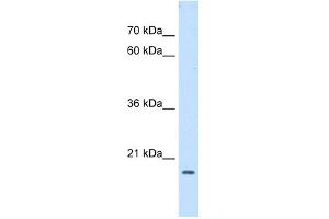 WB Suggested Anti-ASF1B Antibody Titration:  0. (ASF1B anticorps  (Middle Region))