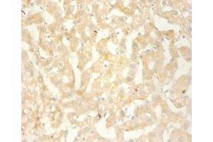 Immunohistochemistry of paraffin-embedded human liver using ABIN7146123 at dilution 1:100 (CXCL13 anticorps  (AA 23-95))