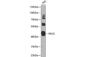 Western blot analysis of extracts of Raji cells, using NEU2 antibody (ABIN6129463, ABIN6144540, ABIN6144541 and ABIN6224161) at 1:1000 dilution. (NEU2 anticorps  (AA 171-380))