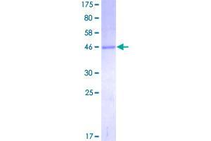 Image no. 1 for O6-Methylguanine-DNA-Methyltransferase (MGMT) (AA 1-207) protein (GST tag) (ABIN1310882)