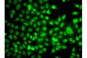 Immunofluorescence analysis of A549 cells using TBL1XR1 antibody. (TBL1XR1 anticorps)