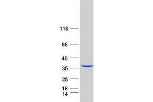 Validation with Western Blot