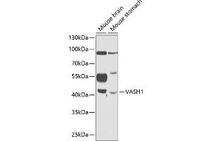 Western blot analysis of extracts of various cell lines, using V antibody (ABIN6128152, ABIN6150060, ABIN6150062 and ABIN6216248) at 1:1000 dilution. (VASH1 anticorps  (AA 1-365))