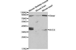 Western blot analysis of extracts of various cell lines, using BVES antibody. (BVES anticorps  (AA 241-360))
