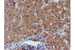 Image no. 9 for anti-Phosphoglucomutase 3 (PGM3) antibody (ABIN1500178) (Phosphoglucomutase 3 anticorps)