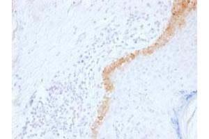 Immunohistochemical staining (Formalin-fixed paraffin-embedded sections) of human skin with KRT15 monoclonal antibody, clone LHK15 . (KRT15 anticorps  (C-Term))