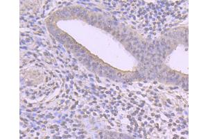 Paraformaldehyde-fixed, paraffin embedded human uterus tissue, Antigen retrieval by boiling in sodium citrate buffer (pH6) for 15min, Block endogenous peroxidase by 3% hydrogen peroxide for 30 minutes, Blocking buffer at 37°C for 20min, Antibody incubation with Cyclin A2 (2E9) Monoclonal Antibody  at 1:50 overnight at 4°C, followed by a conjugated secondary and DAB staining.