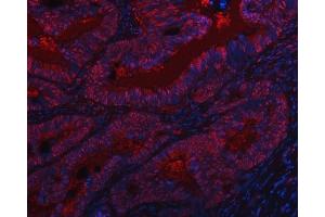 anti-Sin3A-Associated Protein, 130kDa (SAP130) (AA 309-913) antibody