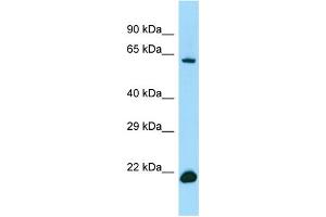 WB Suggested Anti-IRF2BP2 Antibody Titration: 1.