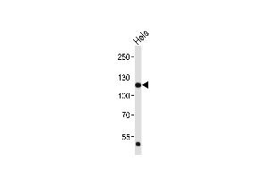Western blot analysis of lysate from Hela cell line, using FGFR1 Antibody (C-term) (ABIN6243222 and ABIN6577089).