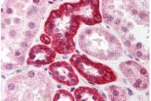 Human Kidney (formalin-fixed, paraffin-embedded) stained with SUMO1 antibody ABIN214521 at 5 ug/ml followed by biotinylated goat anti-rabbit IgG secondary antibody ABIN481713, alkaline phosphatase-streptavidin and chromogen. (SUMO1 anticorps  (N-Term))