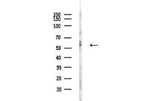 anti-Hyaluronan Synthase 2 (HAS2) (C-Term) antibody