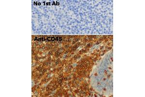 Immunohistochemistry (IHC) image for anti-Protein tyrosine Phosphatase, Receptor Type, C (PTPRC) (C-Term) antibody (ABIN6254210)