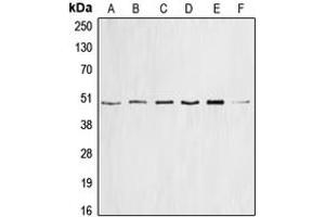 Western blot analysis of Cyclin E1 expression in HEK293T (A), mouse brain (B), PC12 (C), SW626 (D), HeLa (E), K562 (F) whole cell lysates.