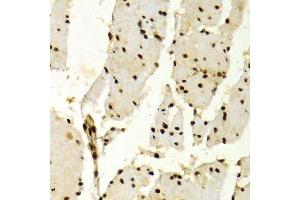 Immunohistochemistry of paraffin-embedded human esophagus using KPNA4 Antibody.