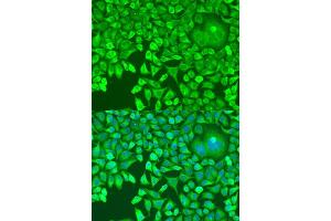 Immunofluorescence analysis of U2OS cells using Pumilio 1 antibody (ABIN6132539, ABIN6146494, ABIN6146496 and ABIN6217367) at dilution of 1:100.