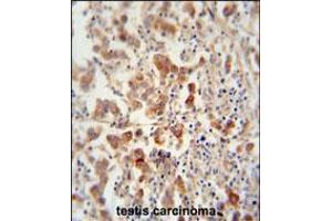 TEX13B antibody immunohistochemistry analysis in formalin fixed and paraffin embedded human testis carcinoma followed by peroxidase conjugation of the secondary antibody and DAB staining. (TEX13B anticorps  (C-Term))