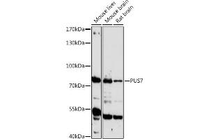 Western blot analysis of extracts of various cell lines, using PUS7 antibody (ABIN7269739) at 1:1000 dilution. (PUS7 anticorps  (AA 352-661))