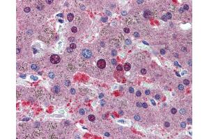 Immunohistochemistry (IHC) image for anti-CUGBP, Elav-Like Family Member 1 (CELF1) (Middle Region) antibody (ABIN2778749)