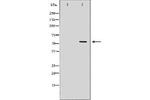 Western blot analysis of Hela whole cell lysates, using KPNA4 Antibody.