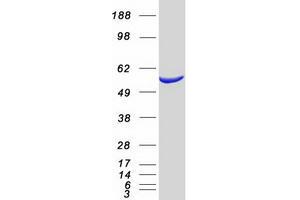 Validation with Western Blot