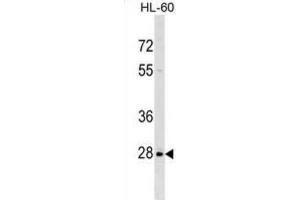 Western Blotting (WB) image for anti-Peptidylprolyl Isomerase (Cyclophilin)-Like 6 (PPIL6) antibody (ABIN2999694) (PPIL6 anticorps)