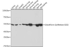 Western blot analysis of extracts of various cell lines, using Glutathione Synthetase (GSS) (GSS) Rabbit mAb (ABIN7267452) at 1:1000 dilution. (Glutathione Synthetase anticorps)