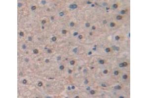IHC-P analysis of Human Tissue, with DAB staining. (HIST1H2AJ anticorps  (AA 1-128))