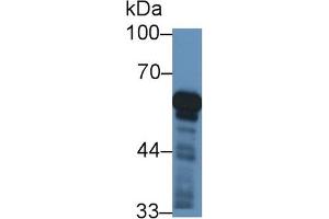 Detection of CYP11B1 in Rat Adrenal gland lysate using Polyclonal Antibody to Cytochrome P450 11B1 (CYP11B1) (CYP11B1 anticorps  (AA 1-498))