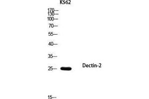 Western Blot (WB) analysis of K562 using Dectin-2 antibody. (C-Type Lectin Domain Family 6, Member A (CLEC6A) anticorps)