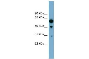 ARHGAP15 antibody used at 1 ug/ml to detect target protein. (ARHGAP15 anticorps  (Middle Region))