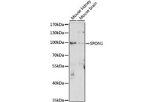 Western blot analysis of extracts of various cell lines, using SPON1 antibody (ABIN7270552) at 1:1000 dilution. (SPON1 anticorps  (AA 29-300))