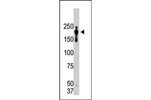 Western blot analysis of PRDM2 monoclonal antibody, clone 33AT1045  in lysate from transformed cells.