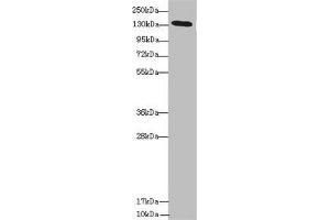 Western blot All lanes: NPHP3 antibody at 1. (NPHP3 anticorps  (AA 1-130))