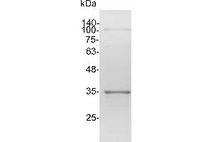 SARS-CoV-2 Nucleocapsid (SARS-CoV-2 N) (B.1.1.529 - Omicron) protein