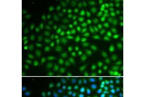 Immunofluorescence analysis of HeLa cells using SMARCA5 Polyclonal Antibody (SMARCA5 anticorps)