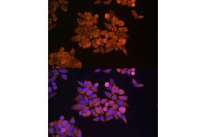 Immunofluorescence analysis of HeLa cells using ETF1 Rabbit pAb (ABIN6129660, ABIN6140313, ABIN6140314 and ABIN6221622) at dilution of 1:100 (40x lens). (ETF1 anticorps  (AA 278-437))