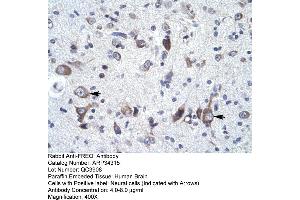 Human Brain (NCS1 anticorps  (N-Term))