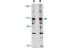 Western blot analysis of DLGAP2 in L1210 cell lysate with DLGAP2 polyclonal antibody  at (A) 0. (DLGAP2 anticorps  (Internal Region))